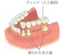 C[W摜